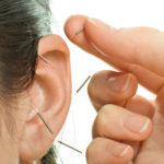 Ohr-Akupunktur